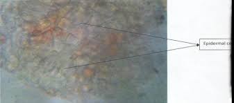 Image result for Fadogia cienkowskii