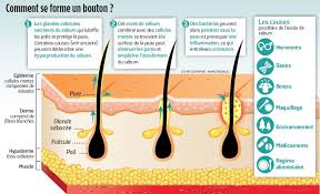 Acne Cinq Conseils Pour S En Debarrasser Le Parisien