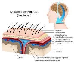 Meningeom Ursachen Beschwerden Therapie Gesundpedia De