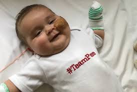 From Virginia to Boston for a kidney transplant: Joshy's story