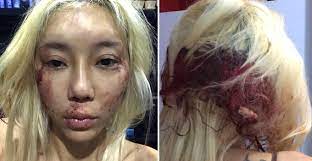 A post shared by leng yein / dj leng yein (@lengyein) on aug 17, 2018 at 3:50pm pdt as someone who does aesthetic procedures, i'd be hypocritical if i frown upon the procedures she had, but too much of a good thing is always bad and to me, leng yein had clearly gone too far and may take the cake from rosmah in later years. Famous Local Dj Leng Yein Exposes Her Abusive Ex In Disturbing Facebook Live Video World Of Buzz