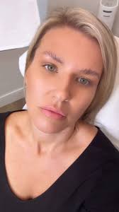 💋 Lips just got a little more kissier thanks to our medical director Dr.  Jamie Faught and @accessmedicalaesthetics I was very particular about my  profile and vermilion boarder and she nailed it!! Best ...