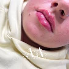 Abbie Arrowsmith Aesthetics