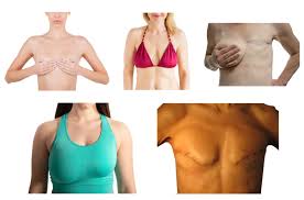 Image result for Breast Augmentation
