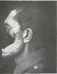 These 20 Vintage Photos Are Unsettling In The Weirdest Ways No Thank You Creepy History Creepy Old Photos Medical Photos