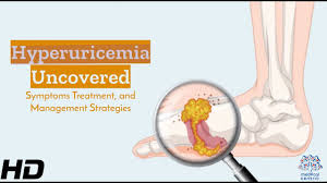 Image result for Hyperuricemia
