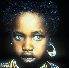 London School of Hygiene & Tropical Medicine