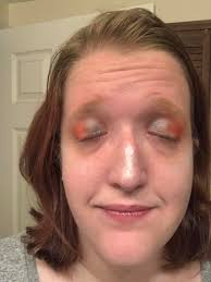 Living with multiple sclerosis effects