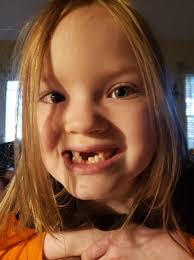 Bray lost another tooth 🦷🧚