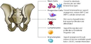 cell therapy bone autograft tucson az quality of life