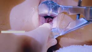 中国拳交女王周晓琳重口味拳交虐阴扩肛80部高清合集（VIP铂金版） - GCBT