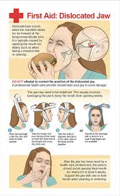 Image result for Jaw Dislocation