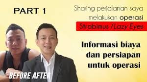 Biaya operasi mata juling di jakarta eye center. Part 1 Informasi Biaya Dan Persiapan Untuk Operasi Strabismus Juling Atau Lazy Eyes Mata Malas Youtube