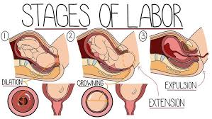 Image result for First Stage of Labor