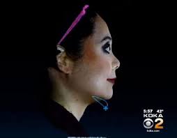 Shot of a new drug could get rid of double chins