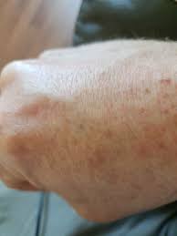 Fill the cup with tattoo ink. I Tattooed Myself With Ink From A Pen What Do I Do Quora