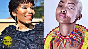 Presently known as free state province in south africa on the 3rd day of january 1892 and died on the. South African Celebrities Suffering From Vitiligo South Africa Rich And Famous