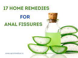 17 Home remedies for anal fissures | Sprint Medical