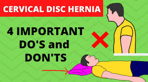 4) how to sleep with a thoracic herniated disc? Cervical Herniated Disc Exercises To Avoid Sleeping Position Precautions Youtube