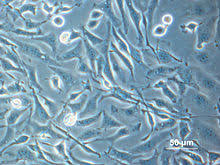 Lysine is an important additive to animal feed because it is a limiting amino acid when optimizing the growth of certain animals such as pigs and chickens for the production of meat. Tissue Culture Wikipedia