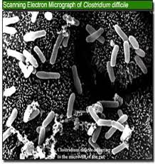 We did not find results for: Gikids Clostridioides Difficile Infection