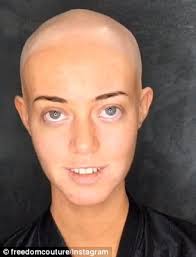 Perth model with Alopecia areata shares video of herself without a wig