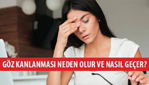 Goz Kanlanmasi Neden Olur Ve Nasil Gecer Optik Gazete