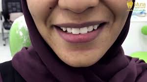 Check spelling or type a new query. Ø²ÙŠØ§Ø±Ø© Ø§Ù„ÙÙ†Ø§Ù†Ø© ÙÙŠ Ø§Ù„Ø´Ø±Ù‚Ø§ÙˆÙŠ ÙˆØ²ÙˆØ¬Ù‡Ø§ Ø§Ù„Ù…Ø®Ø±Ø¬ Ø¹Ø¨Ø¯Ø§Ù„Ù„Ù‡ Ø§Ù„Ø¨ÙƒØ±ÙŠ Ù„Ù…Ø±ÙƒØ² Ù…Ù†Ù‰ Muna Dental Clinic