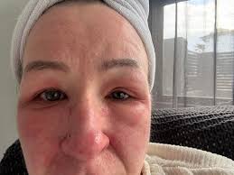 Hearing aid friendly face mask recommendations?