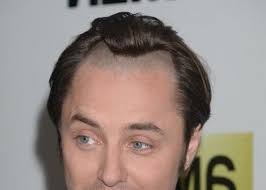 Herren Geheimratsecken Frisuren Moderne Haarschnitt Manner Frisur Geheimratsecken Haarschnitt Ideen
