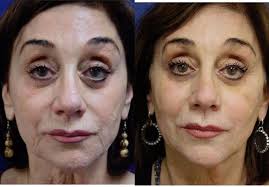 Along the main promenade of portorož, with a private beach, prestigious cuisine and top … Douglas Mest Md Pier Medical Aesthetics 38 Photos 62 Reviews Medical Spas 415 Pier Ave Hermosa Beach Ca United States Phone Number Yelp