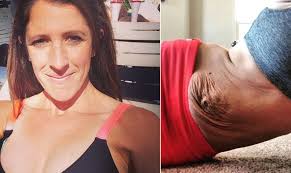 Mulher exibe marcas e efeitos da gravidez no corpo: "Olho para baixo e vejo  que as estrias ficarão"