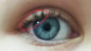 Warum Zuckt Mein Auge So Gesundheit Augen Zucken