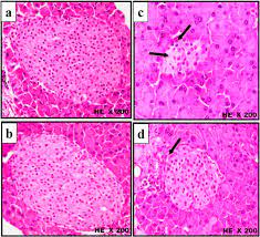 Check spelling or type a new query. Histological Changes In Islets Of Langerhans Of Mice Pancreas After Download Scientific Diagram