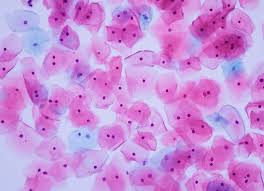 Pap smears: Everything you need to know | The Fornix | Flex