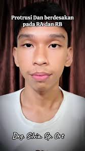 Panduan Perawatan Gigi Gingsul oleh Drg. Silvia