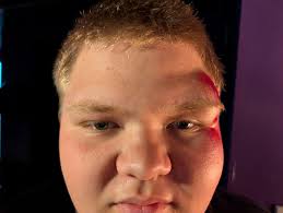 Did the preppy kid wear his helmet in the car or just to fight?