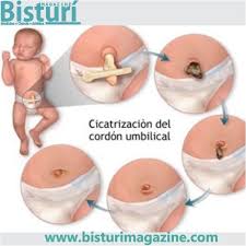 Pin En Natural Birth