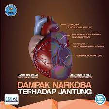 Narkoba adalah singkatan dari narkotika dan obat/bahan berbahaya. Narkoba Adalah Zat Yang Bnn Kota Tangerang Selatan Facebook