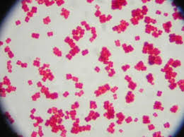 Spherical cells occur in packets; Bacterial Morphology David Fankhauser
