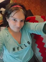 Do people with seizures dream about having seizures?