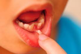 There is a wide age range for when babies start teething. Don T Give Baby Teeth To The Tooth Fairy Bank Them Instead
