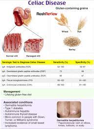 Celiac Disease Medicine Family Medicine Medical Laboratory Science Student