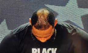 When he's having too much. Lebron James Mocked Over His Receding Hair