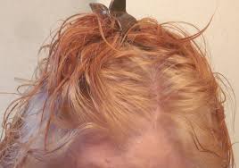 While bleach does lighten your hair, it does not get rid of the natural pigment that gives your hair its color. Orange Hair Misadventures In Going Natural From Dark Brown Part Iii With Christian Eyes