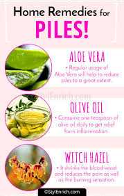 Home Remedies For Piles Home Remedies For Hemorrhoids Piles Remedies Hemorrhoid Remedies