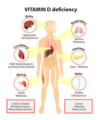 Asimismo la vitamina d sirve para la coagulación sanguínea, por lo que si la consumes de manera correcta podrás prevenir hemorragias. Importancia De La Vitamina D Para Los Huesos