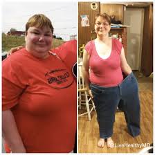 Pin On Patient Before And After