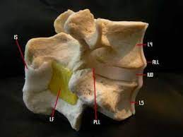 Each ligamentum flavum connects two adjacent vertebrae, beginning with the junction of the axis and third cervical vertebra, continuing down to the junction of the fifth lumbar vertebra and the sacrum. Lumbar Model With The All Pll Ligamentum Flavum And Interspinous Lig Youtube