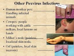 Often, people in africa get when they are bitten by animals, or scratched, or if infected wild eat. Poxviruses Classification Of Poxviruses V Family Poxviridae V
